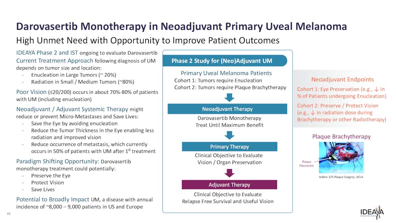 Darovasertib Monotherapy in Neoadjuvant Primary Uveal Melanoma