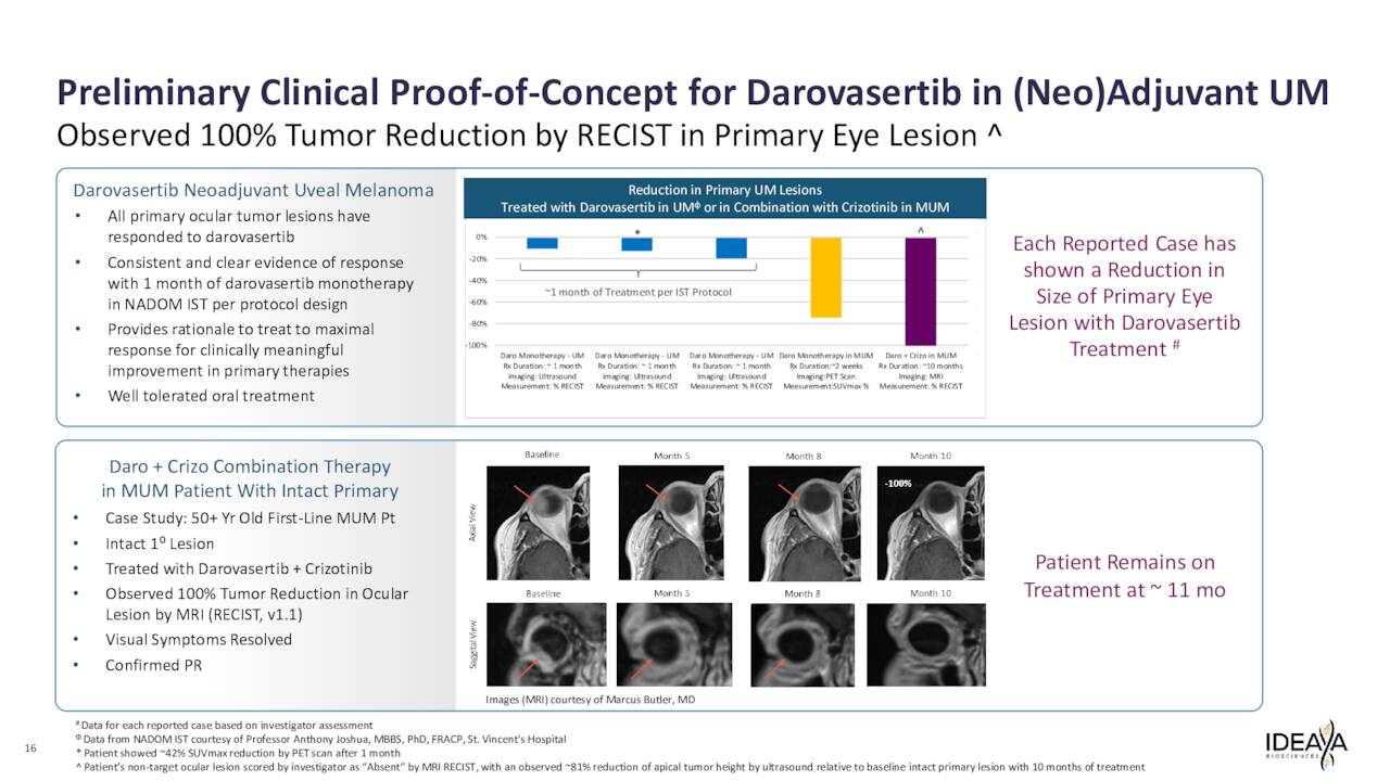 Preliminary Clinical Proof-of-Concept for Darovasertib in (Neo)Adjuvant UM