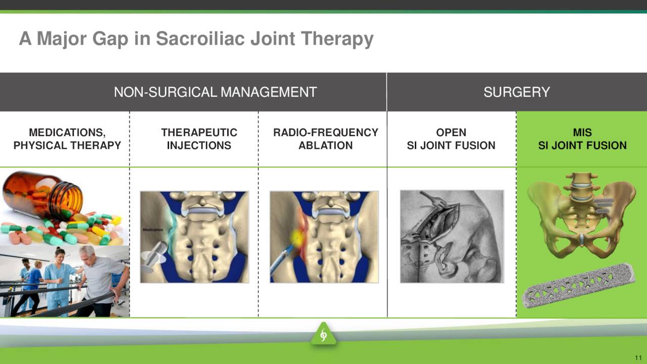 A Major Gap in Sacroiliac Joint Therapy