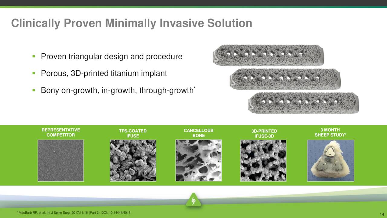 Clinically Proven Minimally Invasive Solution