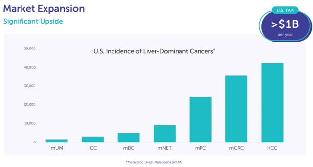 list of prevalence of various forms of metastatic liver cancer